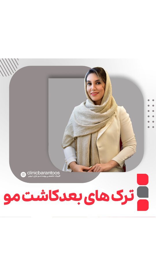 علت ایجاد ترک‌های پوستی پس از کاشت مو + راهکار و سوالات متداول